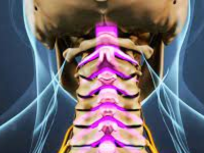 Spinal Stenosis Surgery